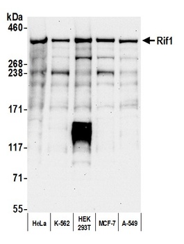 Rabbit RIF1 Antibody