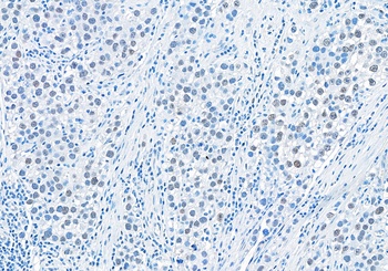 Rabbit RIF1 Antibody