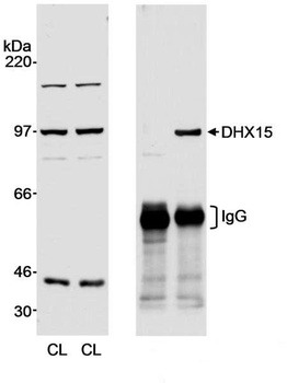 Rabbit DHX15 Antibody