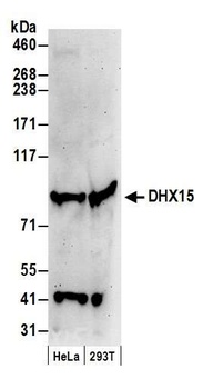 Rabbit DHX15 Antibody