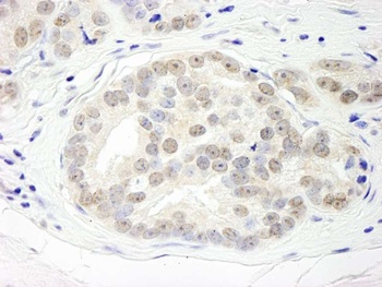Rabbit DHX15 Antibody