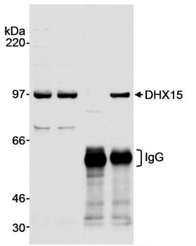 Rabbit DHX15 Antibody