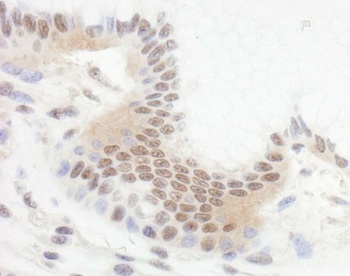 Rabbit Bcl11b Antibody