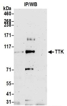 Rabbit TTK Antibody