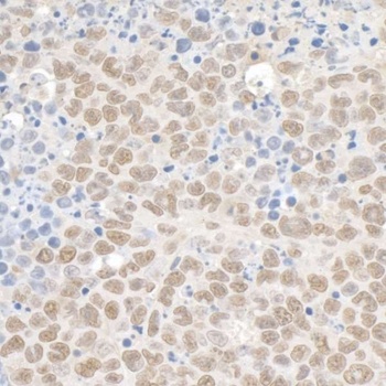 Rabbit KAP-1 Antibody