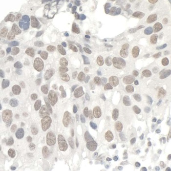 Rabbit KAP-1 Antibody