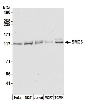 Rabbit SMC6 Antibody