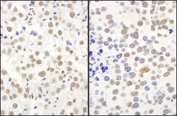 Rabbit QKI Antibody