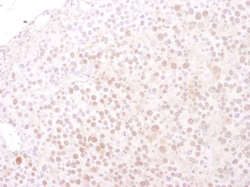 Goat MCM4 Antibody