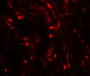 WFDC2 Antibody