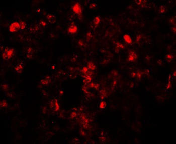 TSN Antibody