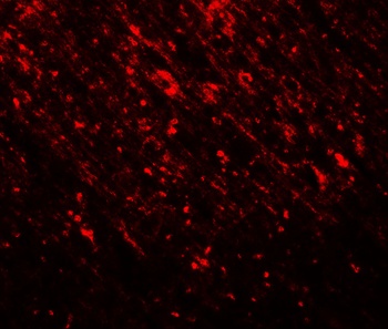 TLX2 Antibody