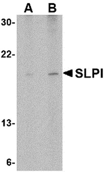 SLPI Antibody