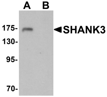 SHANK3 Antibody