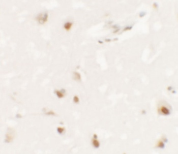SHANK3 Antibody