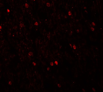 SHANK3 Antibody