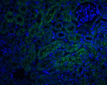 TNFRSF10D Antibody