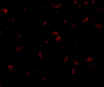DLGAP1 Antibody
