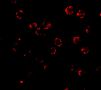 RNASEH2A Antibody