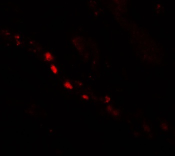PTCHD2 Antibody