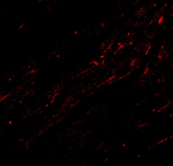 CIDEA Antibody