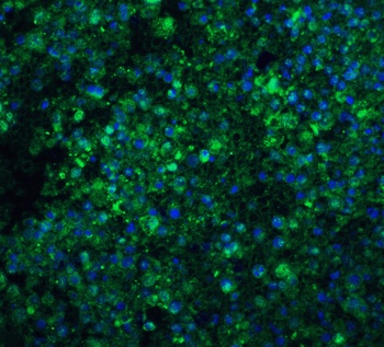 CIDEA Antibody
