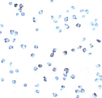 TNFRSF25 Antibody