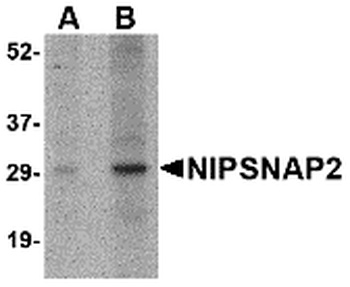 GBAS Antibody