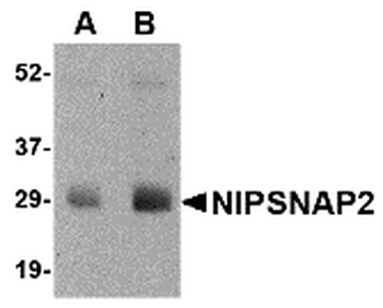 GBAS Antibody
