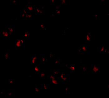 PAFAH1B1 Antibody