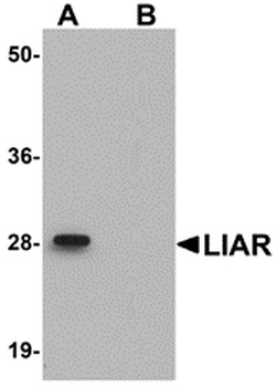 ANKRD54 Antibody