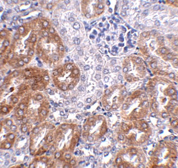 ANKRD54 Antibody