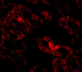 ANKRD54 Antibody