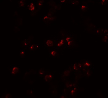 IL22 Antibody