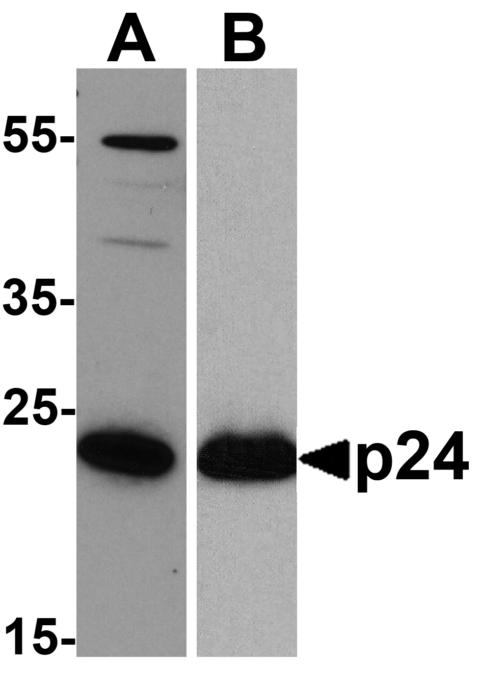 GAG Antibody