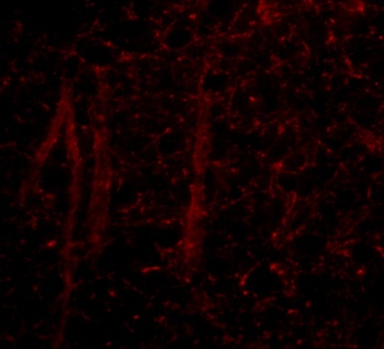 GLE1 Antibody