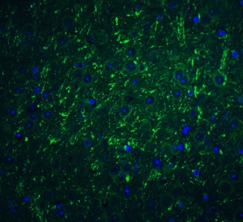 PDCD1LG2 Antibody