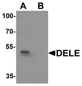 KIAA0141 Antibody
