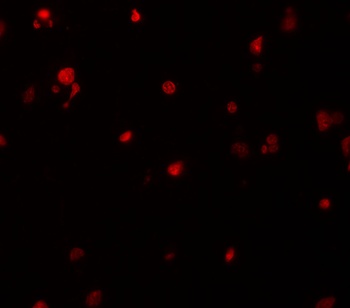 KIAA0141 Antibody