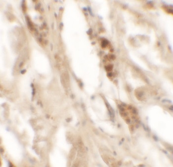 DBX2 Antibody