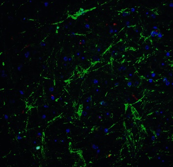 SOX2 Antibody