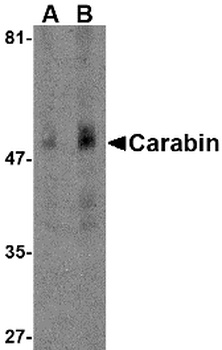 TBC1D10C Antibody
