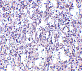 TBC1D10C Antibody
