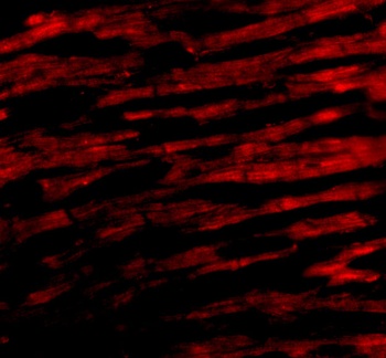 BCL2L13 Antibody