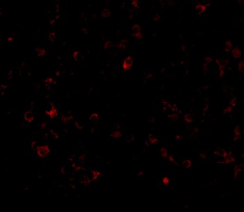 CD5L Antibody