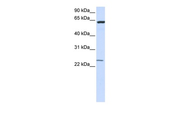 TMEM138 Antibody