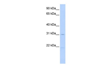 SLC25A21 Antibody