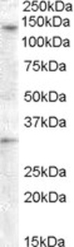 GC Antibody