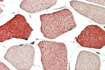 TOM1L2 Antibody