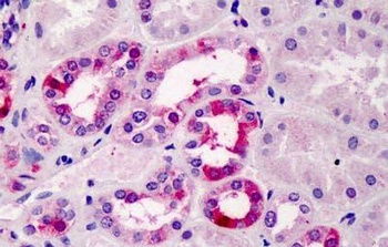 Tcfec Antibody